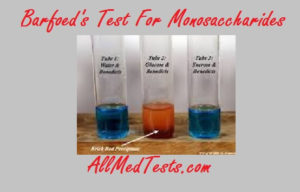 barfoed's test, its principle, procedure, results etc