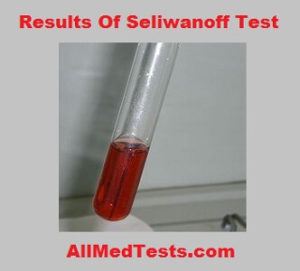 Seliwanoff’s Test result