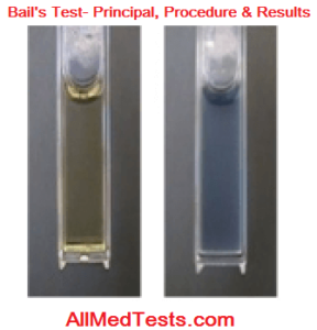 bail's test