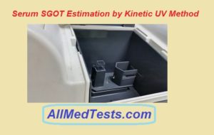 serum sgot test